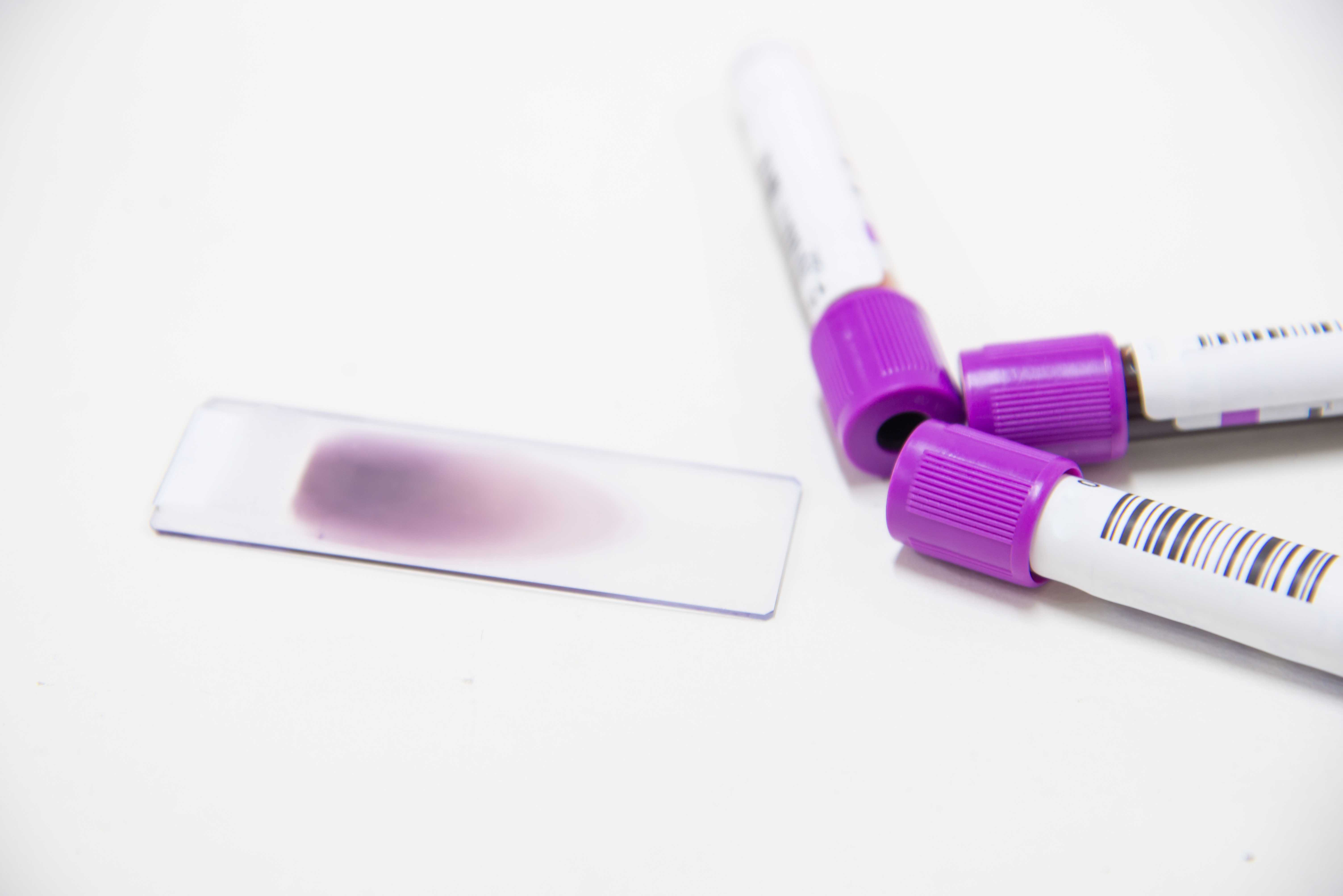 hematologia-servicio-laboratorioclinico