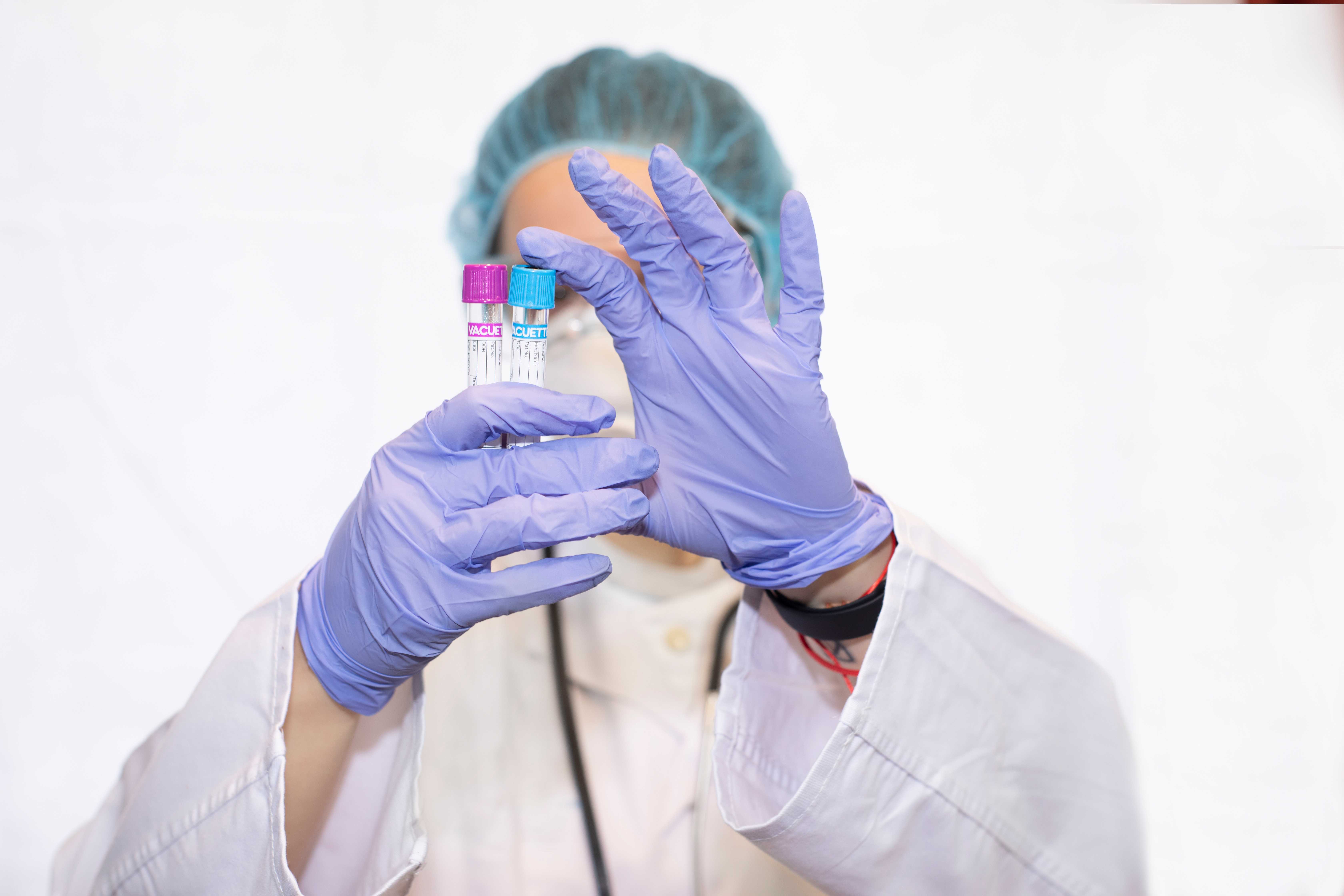 coagulacion-servicio-laboratorioclinico