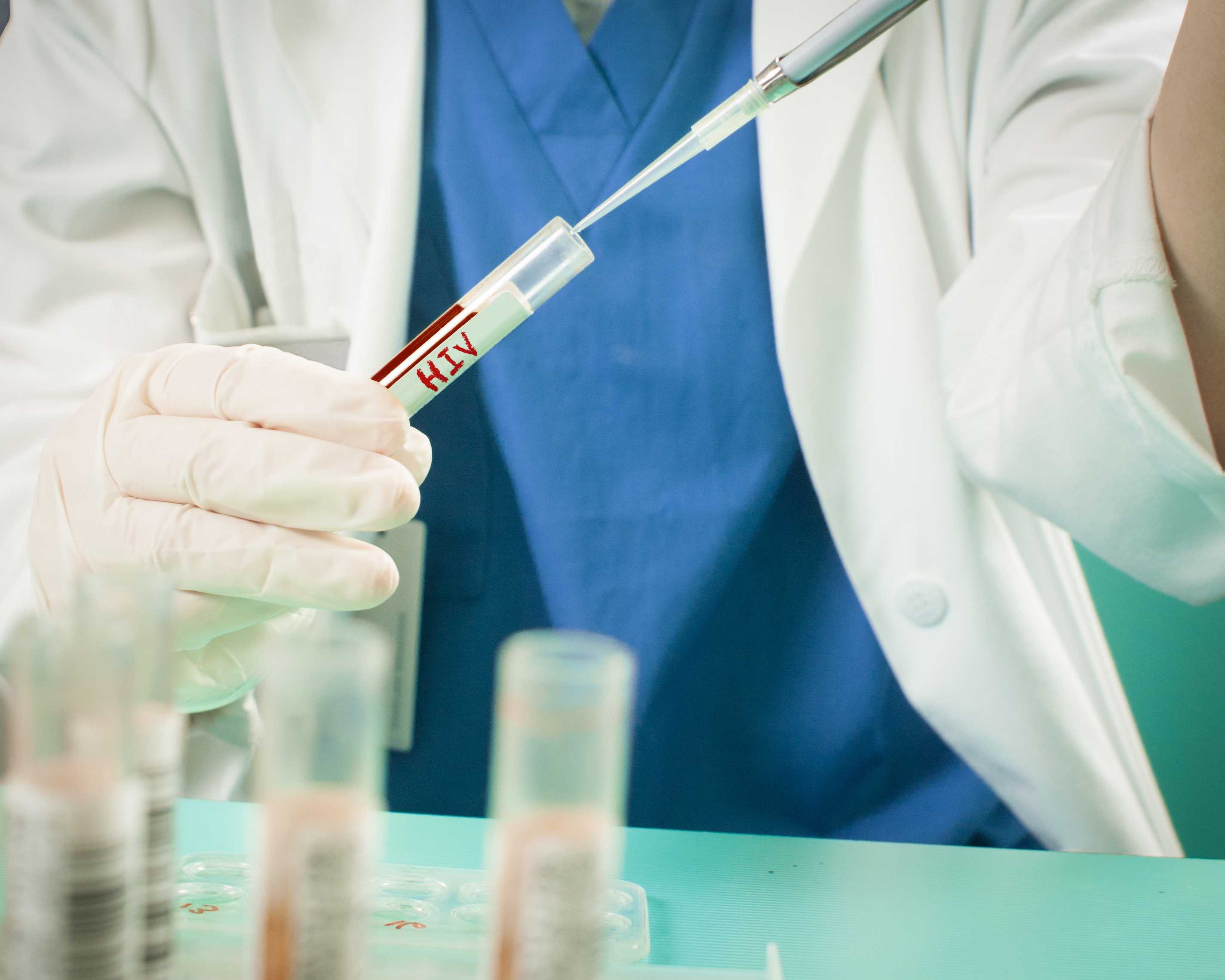 inmunologia-servicio-laboratorioclinico